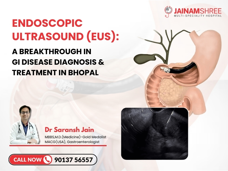 Endoscopic Ultrasound (EUS): Advanced Diagnosis & Treatment of GI Diseases in Bhopal