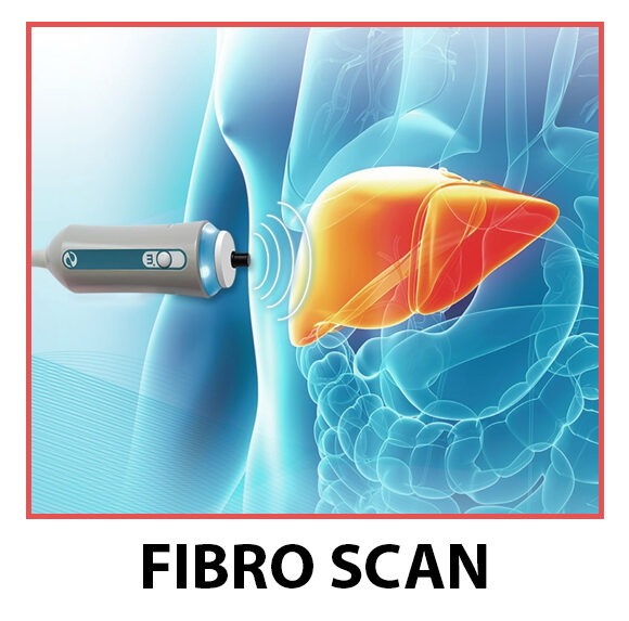 FibroScan liver examination illustration showing non-invasive liver stiffness measurement using transient elastography technology to assess liver fibrosis, fatty liver disease, and chronic liver disorders. Advanced liver diagnostics at Jainamshree Multispeciality Hospital, Bhopal.