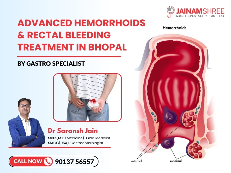 Best Gastroenterologist in Bhopal for Hemorrhoids & Rectal Bleeding Treatment