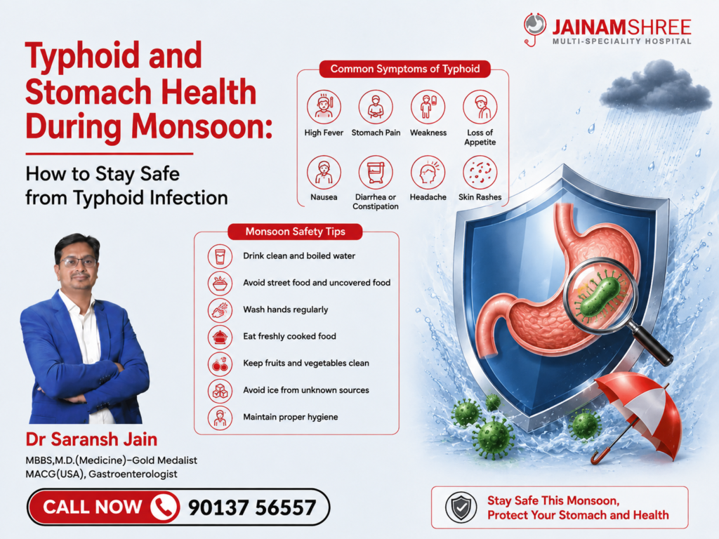 Typhoid and Stomach Health During Monsoon: How to Stay Safe from Typhoid Infection